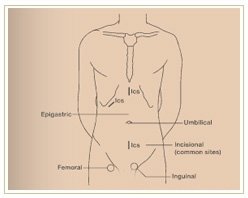 Slider image (9) Adiva | Super Speciality Care